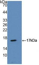 DAB staining on IHC-P; Samples: Mouse Uterus Tissue; Primary Ab: 10µg/ml Rabbit Anti-Mouse ANXA2 Antibody Second Ab: 2µg/mL HRP-Linked Caprine Anti-Rabbit IgG Polyclonal Antibody