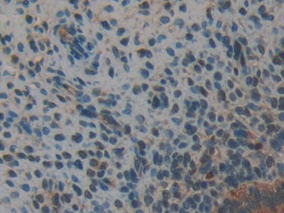 DAB staining on IHC-P; Samples: Mouse Vas Deferens Tissue