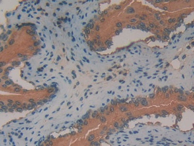 Annexin A2 (ANXA2) Polyclonal Antibody - image 5