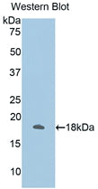 Used in DAB staining on fromalin fixed paraffin-embedded Intestine tissue