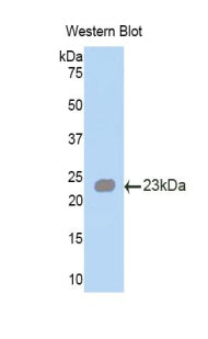 Angiopoietin Like Protein 2 (ANGPTL2) Polyclonal Antibody - image 2