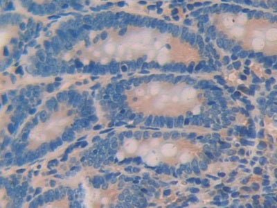 DAB staining on fromalin fixed paraffin- embedded stomach tissue)