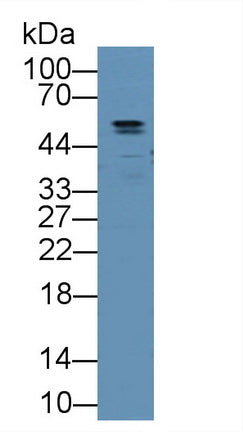 DAB staining on IHC-P; Samples: Human Stomach Tissue;  Primary Ab: 20µg/ml Rabbit Anti-Human ANGPTL2