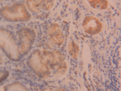 DAB staining on IHC-P; Samples: Human Stomach Tissue