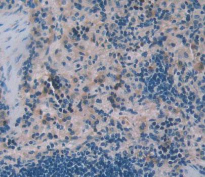 Wiskott Aldrich Syndrome Protein (WASP) Polyclonal Antibody - image 3