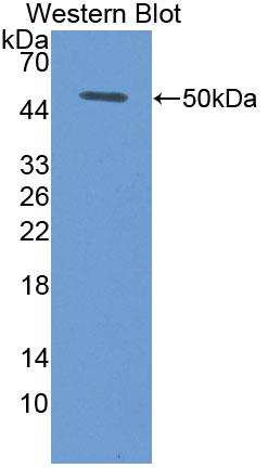 Bruton'S Tyrosine Kinase (Btk) Polyclonal Antibody - image 2