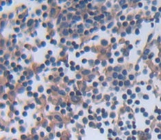 Bruton'S Tyrosine Kinase (Btk) Polyclonal Antibody - image 3