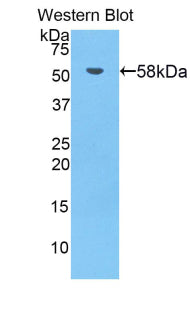 Bruton'S Tyrosine Kinase (Btk) Polyclonal Antibody - image 2