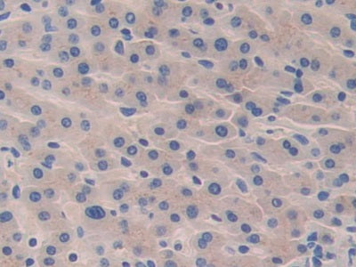 DABstainingonIHC-P.Samples:HumanTissue)