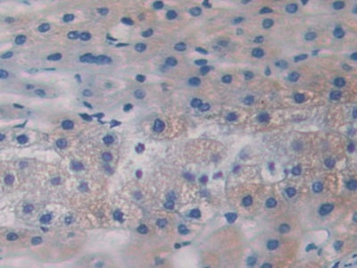 Bruton'S Tyrosine Kinase (Btk) Polyclonal Antibody - image 4