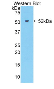 Kallikrein 7 (KLK7) Polyclonal Antibody - image 2