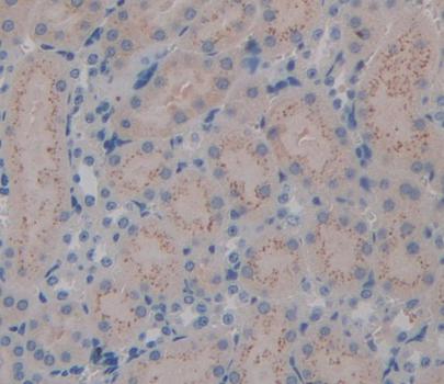 Kallikrein 7 (KLK7) Polyclonal Antibody - image 3