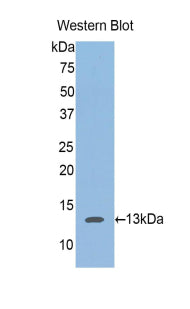 Aggrecan (AGC) Polyclonal Antibody - image 2