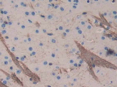 DAB staining on fromalin fixed paraffin- embedded brain tissue)