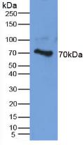 Western Blot; Sample: Recombinant protein.