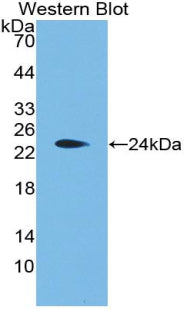 Aggrecan (AGC) Polyclonal Antibody - image 2