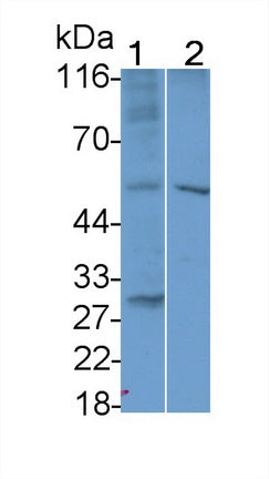 Interleukin 7 Receptor (IL7R) Polyclonal Antibody - image 2