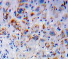 Interleukin 7 Receptor (IL7R) Polyclonal Antibody - image 3