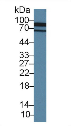 Western Blot; Sample: Recombinant protein.
