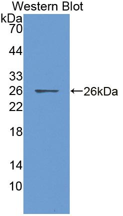 DAB staining on IHC-P; Samples: Human Liver Tissue; Primary Ab: 20μg/ml Rabbit Anti-Human CDHH Antibody Second Ab: 2µg/mL HRP-Linked Caprine Anti-Rabbit IgG Polyclonal Antibody