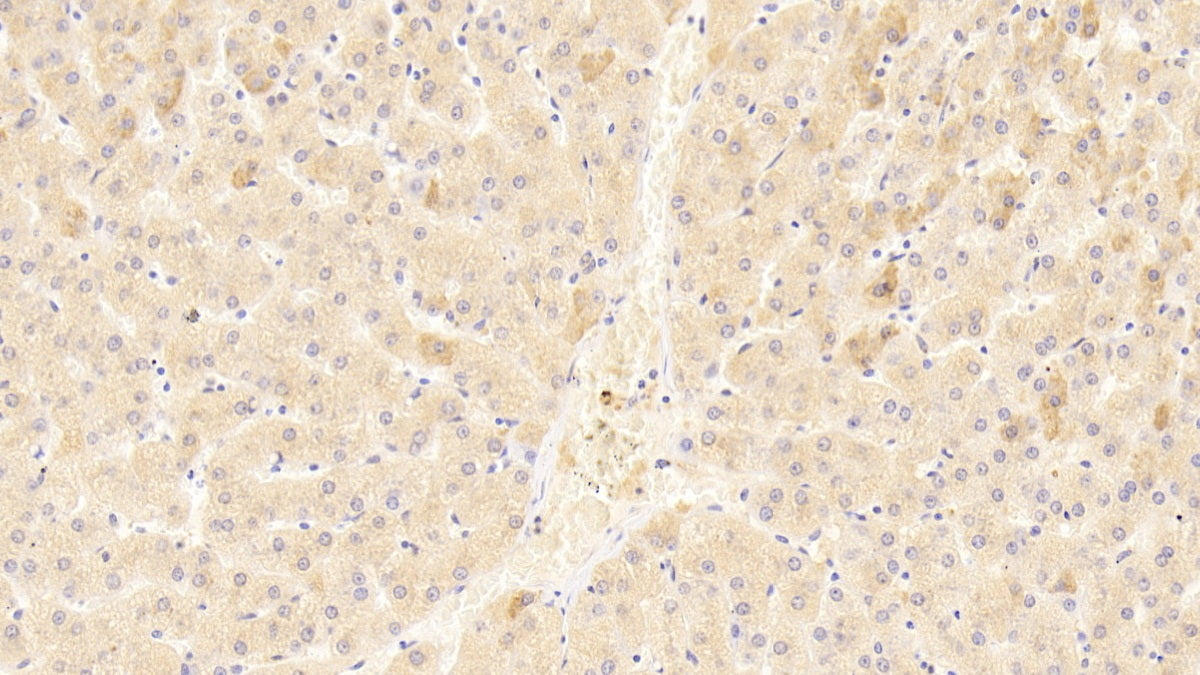 DAB staining on IHC-P. Samples: Human Tissue)