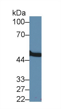 Western Blot; Sample: Recombinant protein.