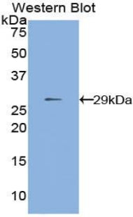 DAB staining on IHC-P; Samples: Human Kidney Tissue; Primary Ab: 10µg/ml Rabbit Anti-Human MMP24 Antibody Second Ab: 2µg/mL HRP-Linked Caprine Anti-Rabbit IgG Polyclonal Antibody