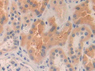 DAB staining on fromalin fixed paraffin-embedded Kidney tissue)