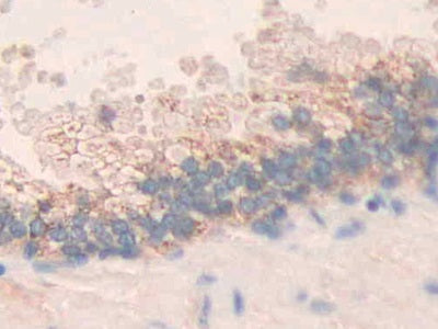 Matrix Metalloproteinase 24 (MMP24) Polyclonal Antibody - image 5