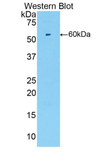 Cyclin Dependent Kinase 2 (CDK2) Polyclonal Antibody - image 2