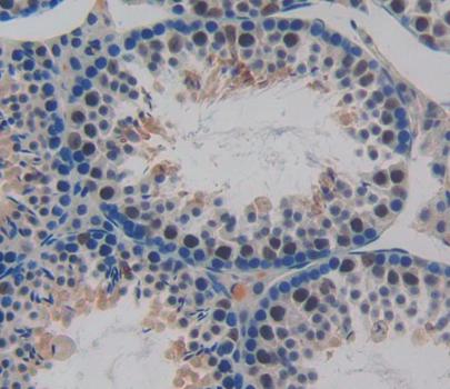 Cyclin Dependent Kinase 2 (CDK2) Polyclonal Antibody - image 3