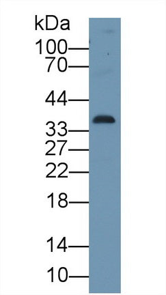 Western Blot; Sample: Recombinant protein.