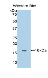 DAB staining on IHC-P; Samples: Human Cerebrum Tissue; Primary Ab: 20µg/ml Rabbit Anti-Human CDK1 Antibody Second Ab: 2µg/mL HRP-Linked Caprine Anti-Rabbit IgG Polyclonal Antibody