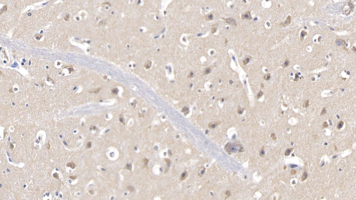 DAB staining on IHC-P. Samples: Human Tissue)
