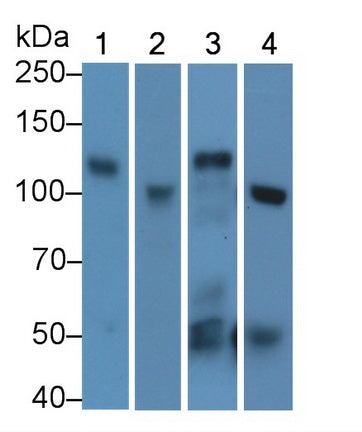 DAB staining on IHC-P; Samples: Rat Spinal cord Tissue; Primary Ab: 10µg/ml Rabbit Anti-Rat ACE2 Antibody Second Ab: 2µg/mL HRP-Linked Caprine Anti-Rabbit IgG Polyclonal Antibody