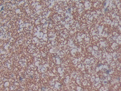 DAB staining on fromalin fixed paraffin- embedded intestine tissue)