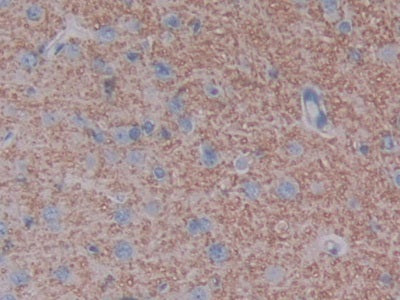 Angiotensin I Converting Enzyme 2 (ACE2) Polyclonal Antibody - image 5