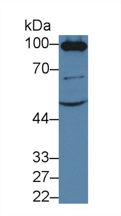 Western Blot; Sample: Mouse Kidney lysate; Primary Ab: 0.3µg/ml Rabbit Anti-Mouse ACE2 Antibody; Second Ab: 0.2µg/mL HRP-Linked Caprine Anti-Rabbit IgG Polyclonal Antibody;