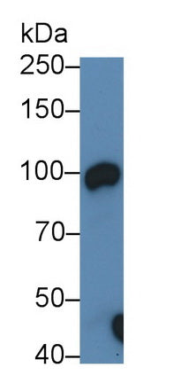 DAB staining on IHC-P; Samples: Mouse Small intestine Tissue; Primary Ab: 20μg/ml Rabbit Anti-Mouse ACE2 Antibody Second Ab: 2µg/mL HRP-Linked Caprine Anti-Rabbit IgG Polyclonal Antibody