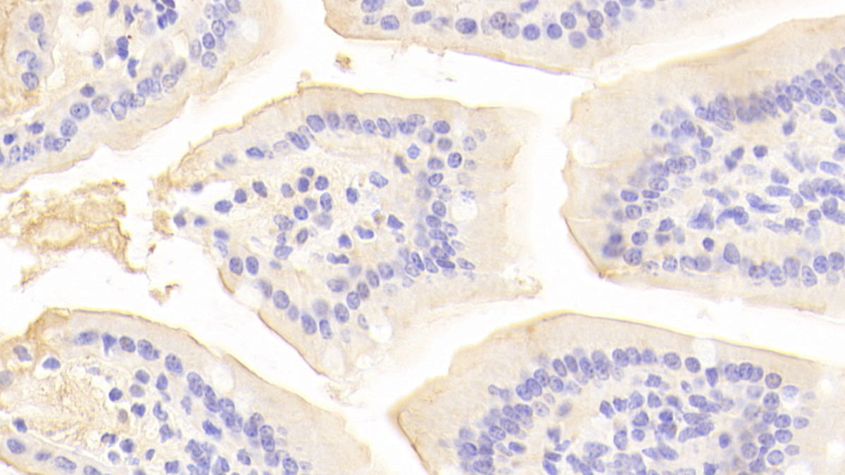 DAB staining on fromalin fixed paraffin-embedded Kidney tissue)
