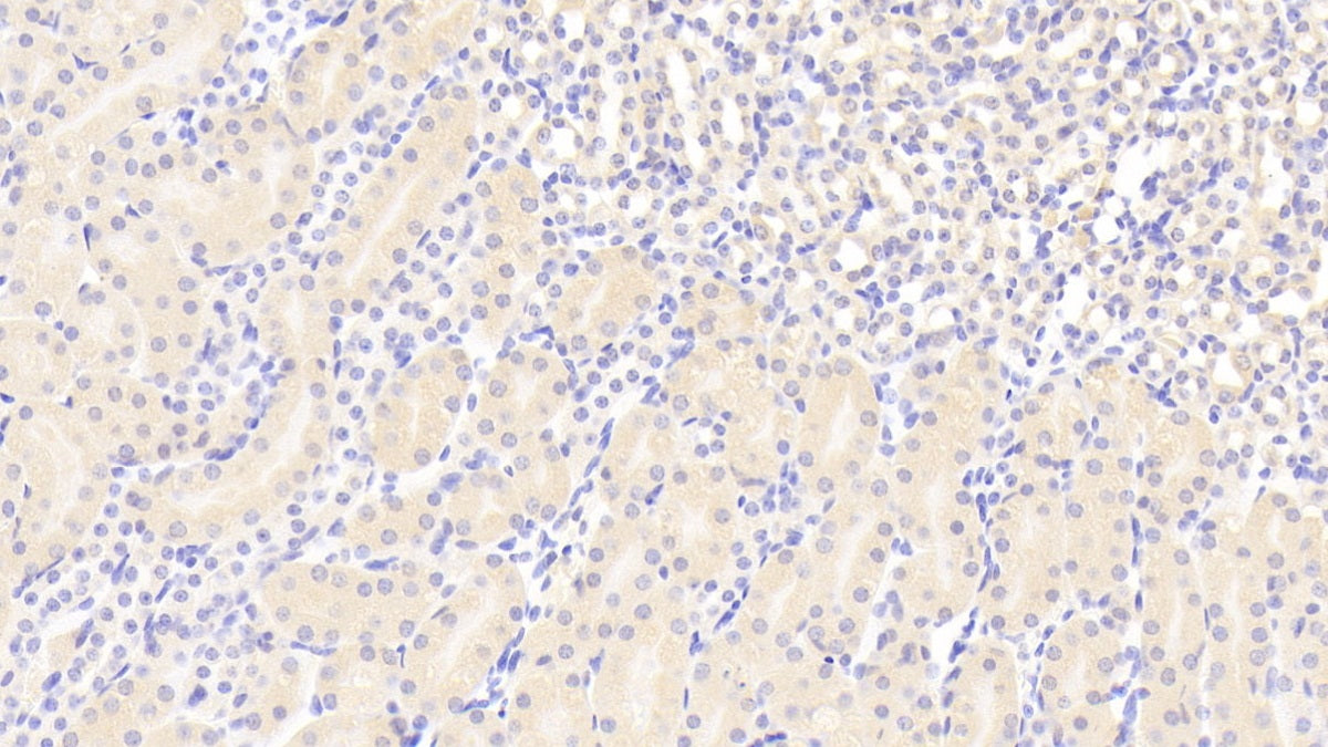 Angiotensin I Converting Enzyme 2 (ACE2) Polyclonal Antibody - image 5
