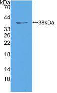 DAB staining on IHC-P; Samples: Mouse Kidney Tissue; Primary Ab: 10µg/ml Rabbit Anti-Mouse EIF3A Antibody Second Ab: 2µg/mL HRP-Linked Caprine Anti-Rabbit IgG Polyclonal Antibody