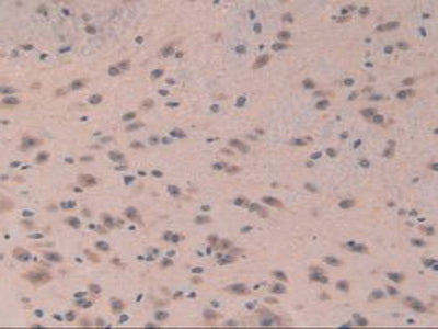 Eukaryotic Translation Initiation Factor 3A (EIF3A) Polyclonal Antibody - image 5