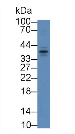 Western Blot; Sample: Recombinant protein.