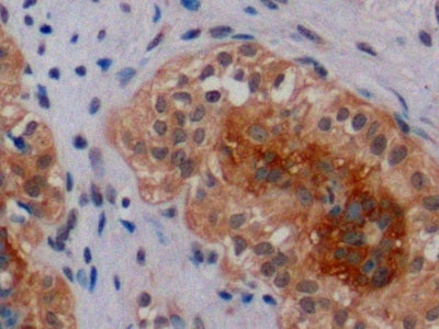 DAB staining on fromalin fixed paraffin- embedded Kidney tissue)