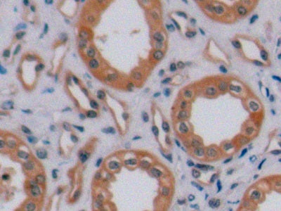 Receptor Tyrosine Protein Kinase erbB-2 (ErbB2) Polyclonal Antibody - image 5