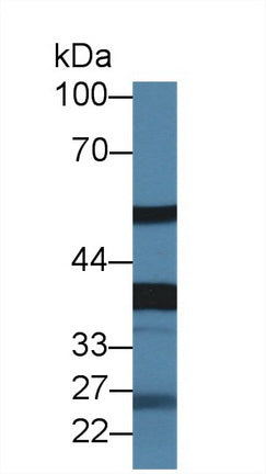 Western Blot; Sample: Recombinant protein.