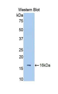 DAB staining on IHC-P; Samples: Rat Liver Tissue;  Primary Ab: 10μg/ml Rabbit Anti-Rat FETUB Antibody Second Ab: 2µg/mL HRP-Linked Caprine Anti-Rabbit IgG Polyclonal Antibody