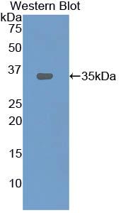 DAB staining on IHC-P; Samples: Rat Kidney Tissue; Primary Ab: 20µg/ml Rabbit Anti-Rat LOX1 Antibody Second Ab: 2µg/mL HRP-Linked Caprine Anti-Rabbit IgG Polyclonal Antibody