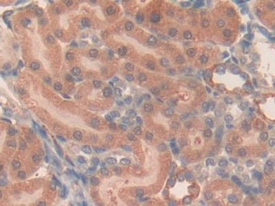 DAB staining on IHC-P; Samples: Rat Spleen Tissue.